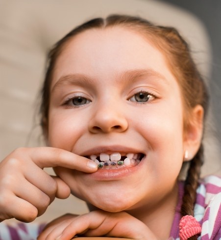 Child pointing to smile after phase on pediatric orthodontics