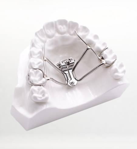 Model smile with orthodontic appliance