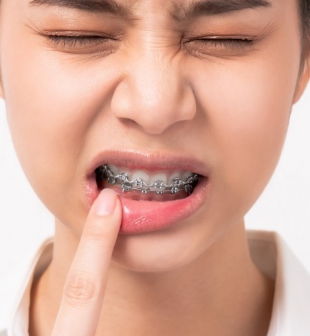 Dental patient pointing to smile during orthodontic emergency