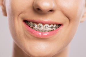 a patient with braces smiling confidently 